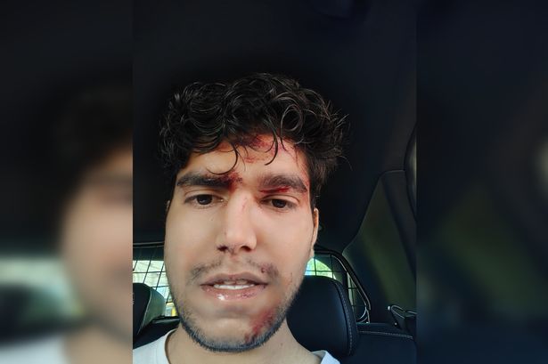 Parth Upadhyay suffered a gash to his left eye