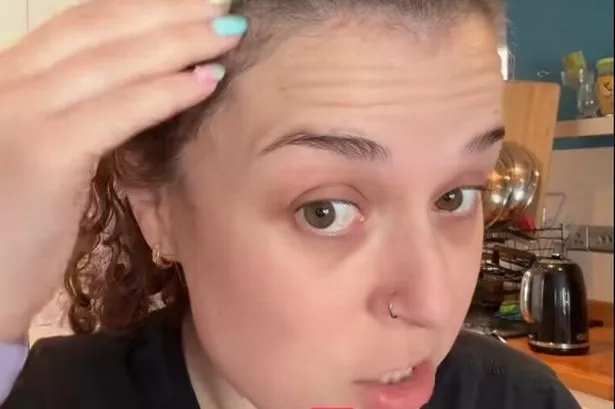 Dani Harmer revealed a diagnosis has left her with troubling symptoms