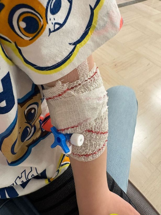 Michael's arm where blood was drawn from