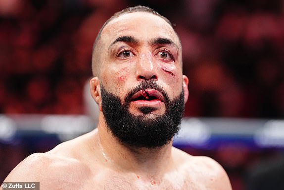MONTREAL, QUEBEC - MAY 10: Belal Muhammad reacts after the UFC welterweight championship bout against Jack Della Maddalena during the UFC 315 event at Bell Centre on May 10, 2025 in Montreal, Quebec. (Photo by Chris Unger/Zuffa LLC)