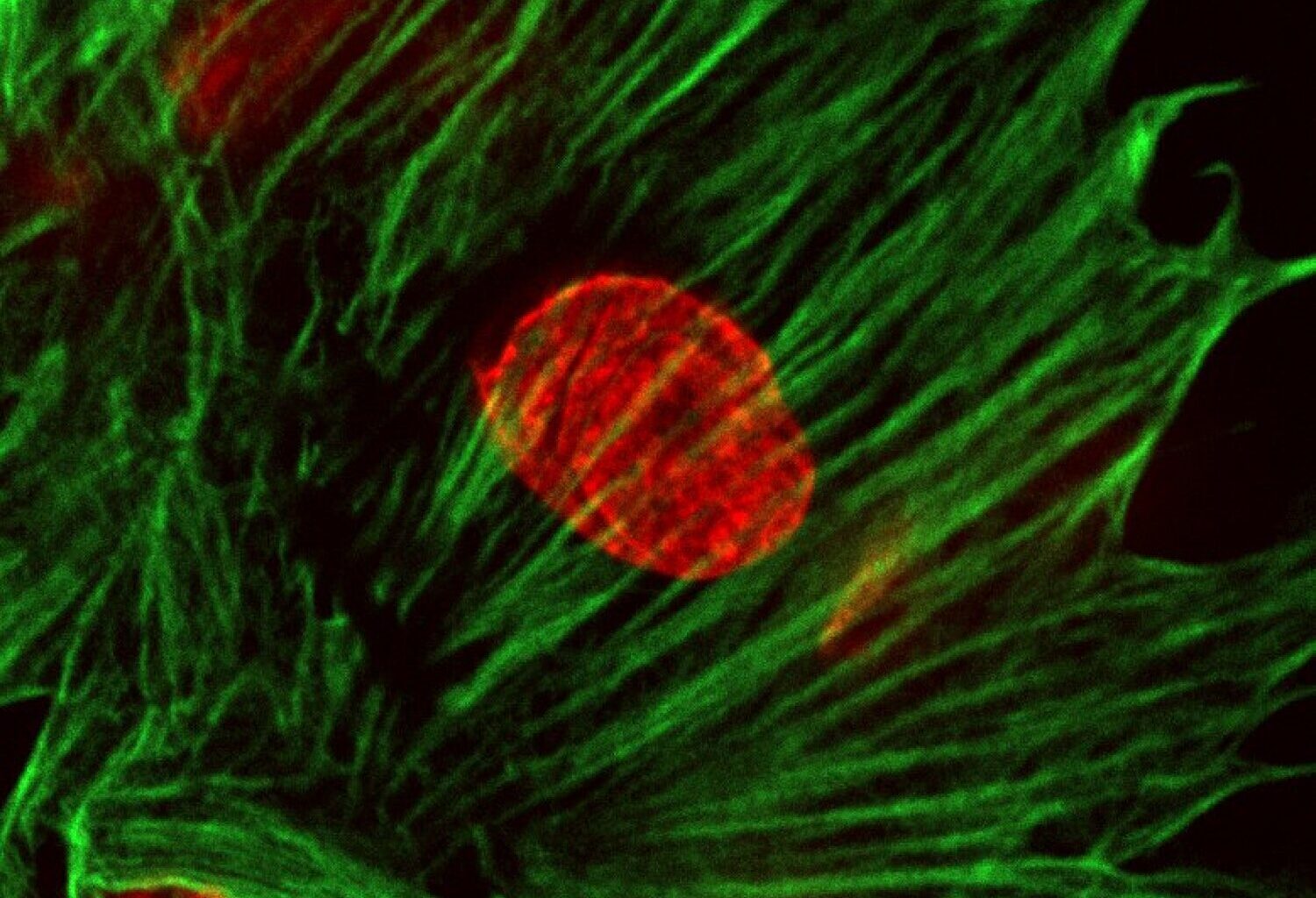 AI can identify genetic perturbations from cell images, offering new path for drug discovery