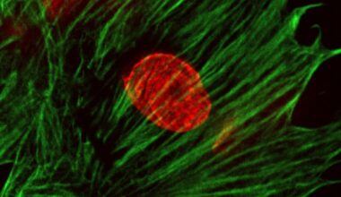 AI can identify genetic perturbations from cell images, offering new path for drug discovery