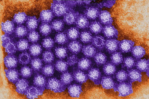  Norovirus virons 