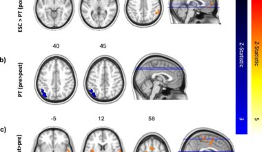 Psilocybin better preserves depressed patients' emotional response to music than standard drug, study finds