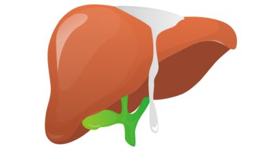 New genetic factor identified in worsening of MASLD, with vitamin B3 as the most effective therapeutic agent