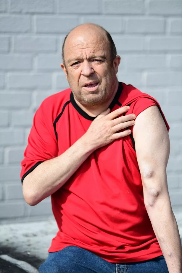 Kevin Haines from Kirkby undergoes dialysis three times a week