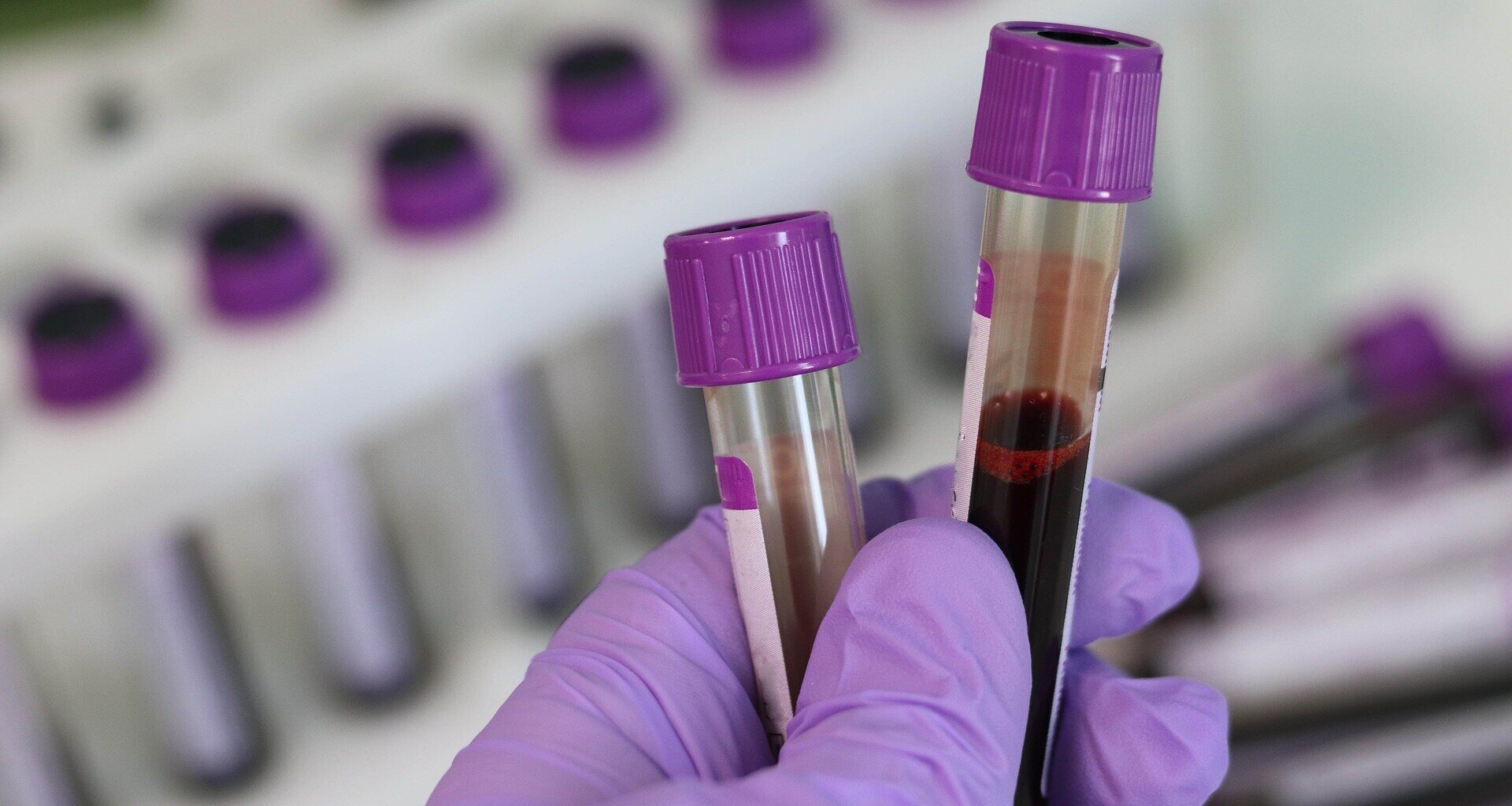 New blood test enables the rapid diagnosis of thousands of rare genetic diseases