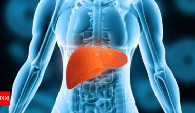 Turmeric for Liver Disease: Common herbal supplement linked to deadly liver disease |