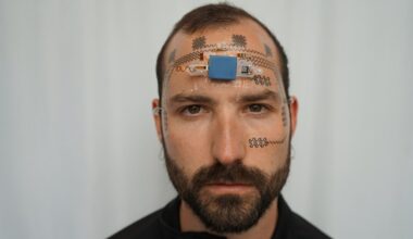 Track your mental stress... with a forehead e-tattoo?