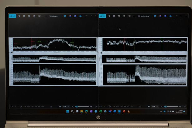 Computer graphic showing effect on blood vessels on the left is normal reading and the right shows blood vessels struggle to dilate