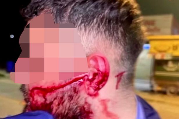 The man was abducted from the street and brutally slashed across the face. 