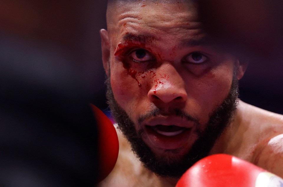 Close-up of Chris Eubank Jr. with a bloody face during a boxing match.