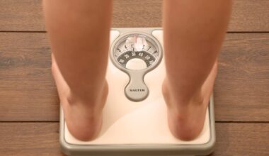 Proportion of adults living with obesity in England, by local area