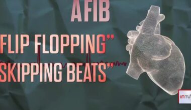 Alternative to blood thinners providing AFib patients the same protection from stroke