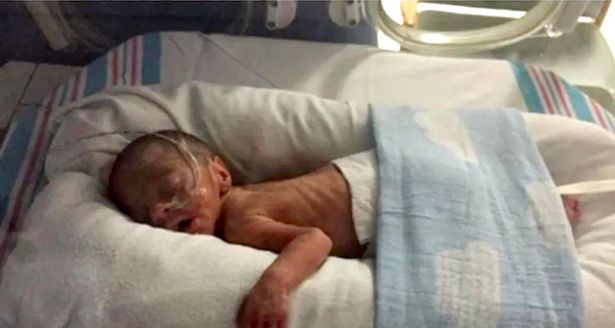 Elijah was born premature at 28 weeks and four days