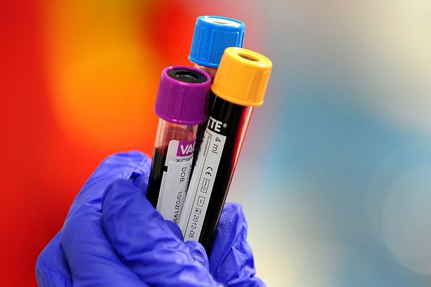 Currently, England remains in Amber alert for low stocks of O negative and O positive blood