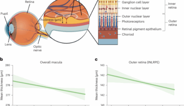 Genetic susceptibility to schizophrenia through neuroinflammatory pathways associated with retinal thinness