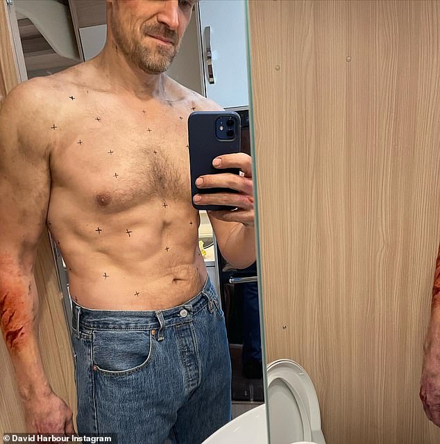 In 2022, he revealed how he lost an incredible five stone for Stranger Things