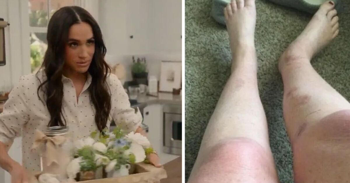 Meghan Markle threatened with £8m lawsuit after Netflix bath salts hack results in ‘burns' | Celebrity News | Showbiz & TV