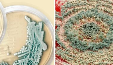 UK warning issued over killer fungus branded 'threat to humanity' | UK | News