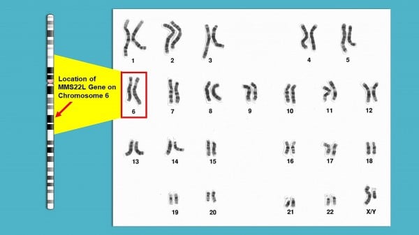 Study Suggests Genetic Mutation in Some Ashkenazi Jewish Men May Be Linked to Higher Prostate Cancer Risk