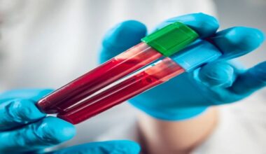 New blood test to boost diagnosis for rare genetic diseases in kids