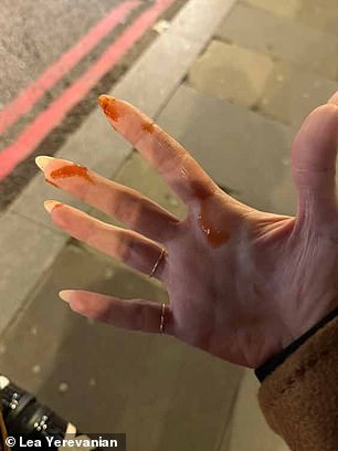 Ms Yerevanian told MailOnline how she was left feeling 'violated' after thieves sprayed her with ketchup in a bid to distract her while they took her belongings. Pictured: Ketchup left on Ms Yerevanian's hand
