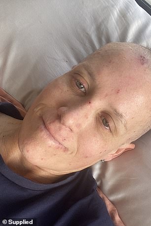 When the cancer returned in 2024, Carly underwent chemotherapy and radiation treatment