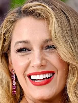 Blake has never publicly confirmed or denied going under the knife, though many have speculated that she has had a rhinoplasty