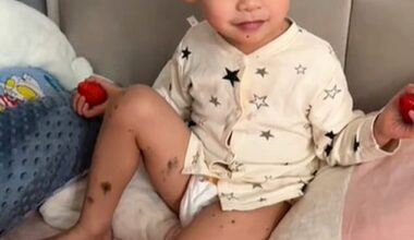 Picture shows the three-year-old Qibao who was teased for looking like Mickey Mouse due to a rare skin condition that led to him having two massive growths on his head