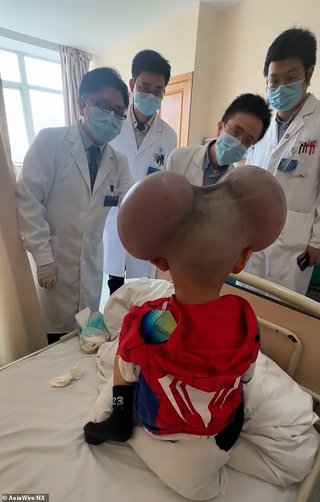 Qibao's condition is primarily caused by an abnormal overgrowth of pigment-producing cells in the skin