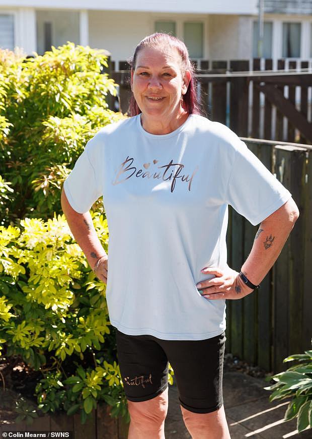 Using diet and exercise only to begin with, the 52-year-old was able to ditch an impressive 6st, taking her to 18st, but she struggled to get any further with her weight loss, despite keeping up with natural technique