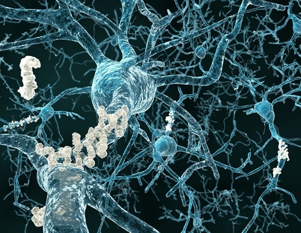 Researchers unravel the genetic contributions to familial Alzheimer's disease development