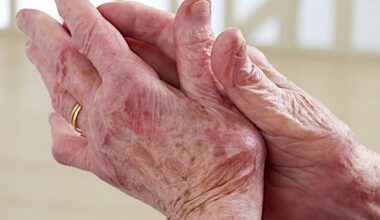 Common anti-inflammatory drugs may aid virus spread