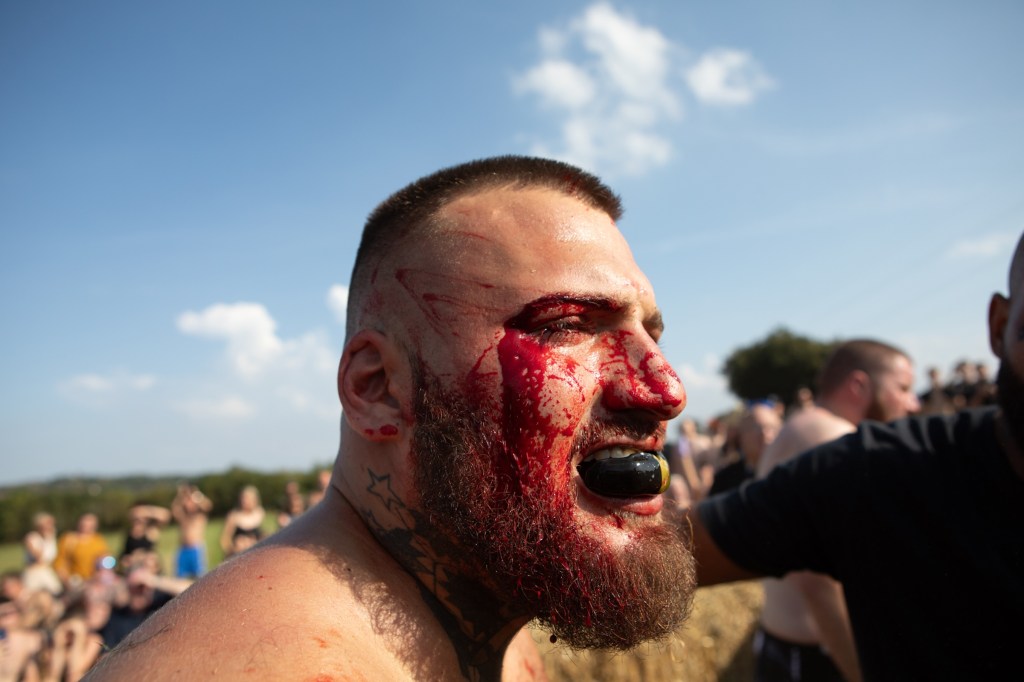 A man bleeds from the face