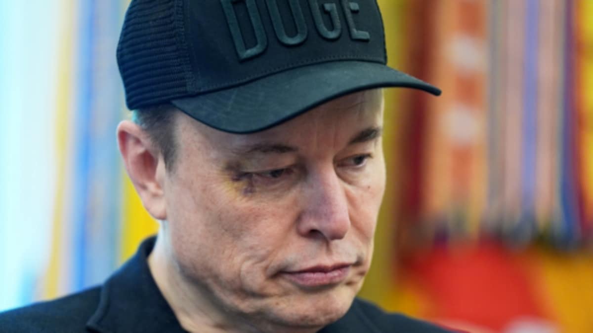 Elon Musk reveals where his black eye came from & France has nothing to do with it – Firstpost