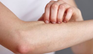 Fungi on Your Skin Could Produce a Potent Antibiotic to Fight Infections : ScienceAlert