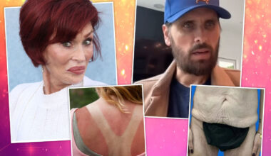 Brutal 'Ozempic aftermath' warning as experts reveal horror side effects flooding clinics & the celebs blighted by it