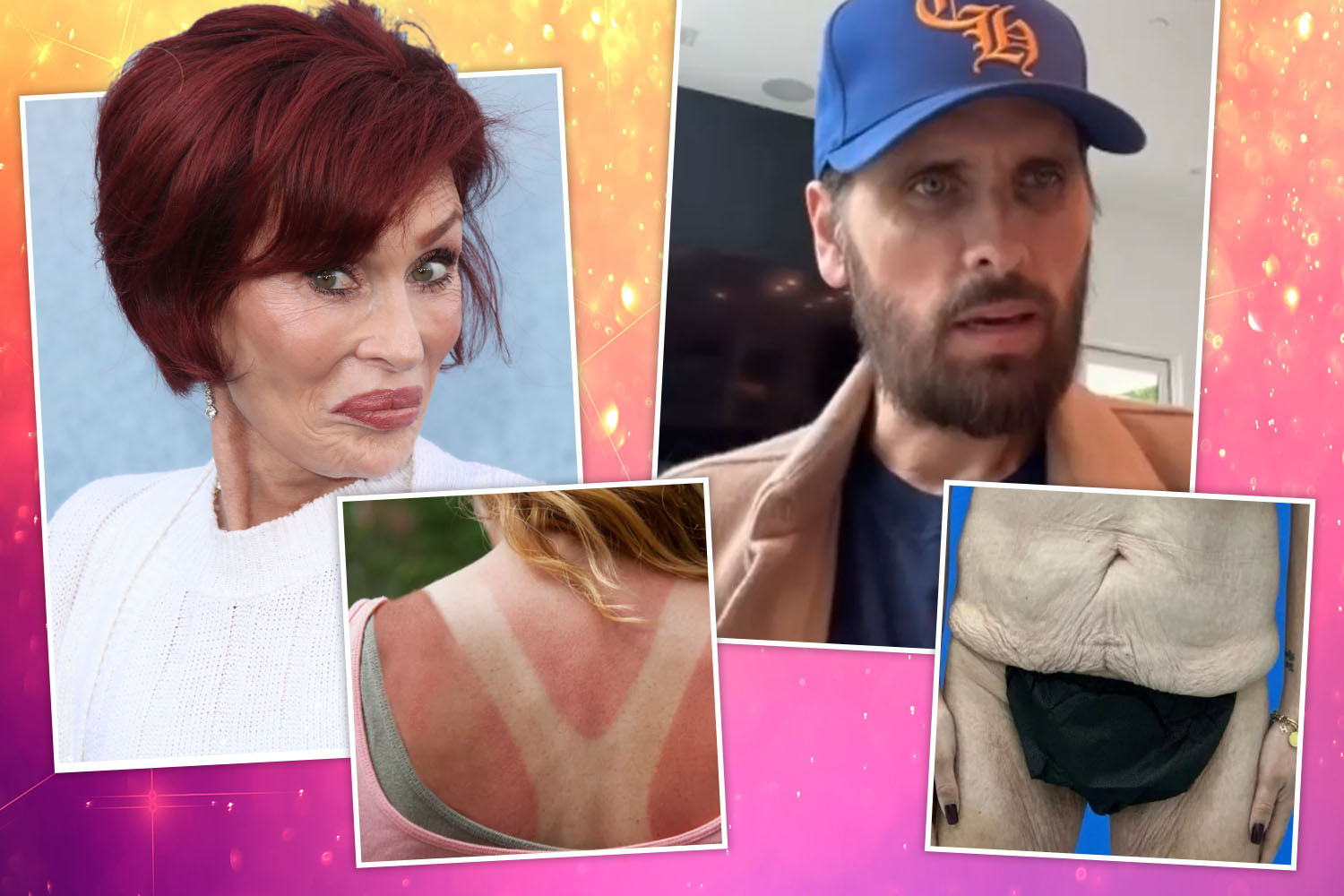 Brutal 'Ozempic aftermath' warning as experts reveal horror side effects flooding clinics & the celebs blighted by it