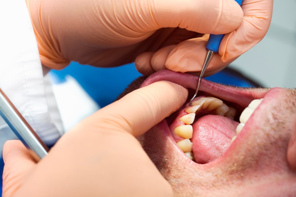 Close-up of a dentist examining a patient's teeth.