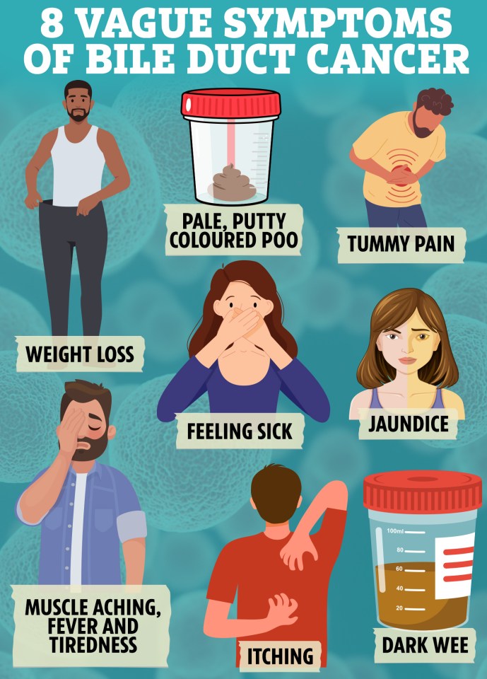 Illustration of eight vague symptoms of bile duct cancer: weight loss, pale putty-colored poo, tummy pain, feeling sick, jaundice, muscle aching, fever and tiredness, itching, and dark wee.