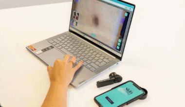 Skin Analytics raises £15m to expand AI skin cancer detection tech