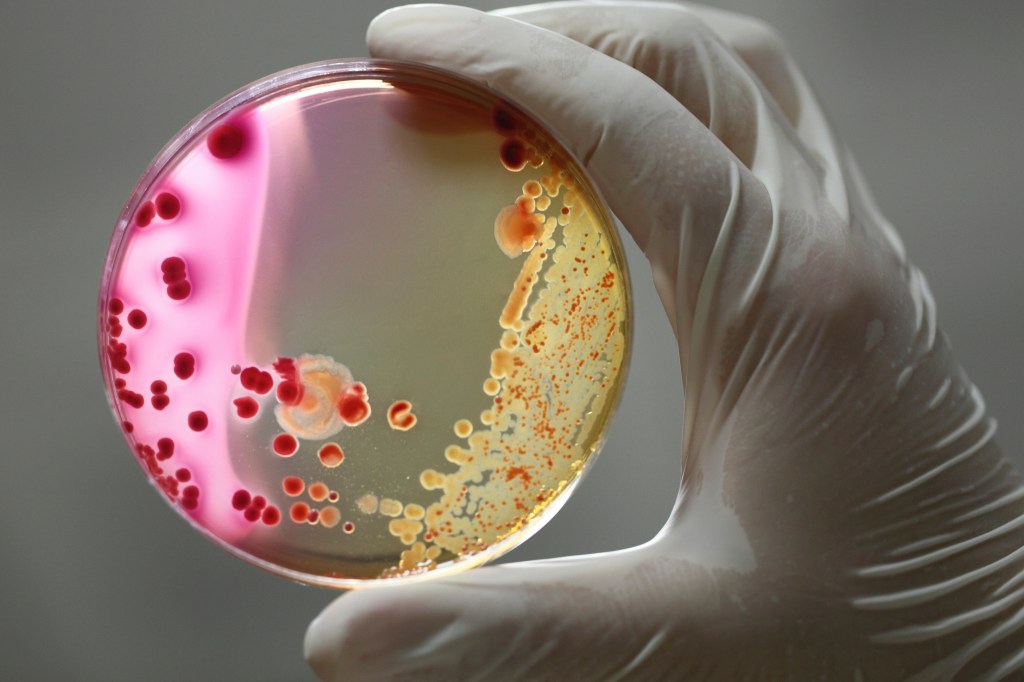 Bacteria in a petri dish similar to that swabbed with sterile wipes on the Tiangong Space Station.