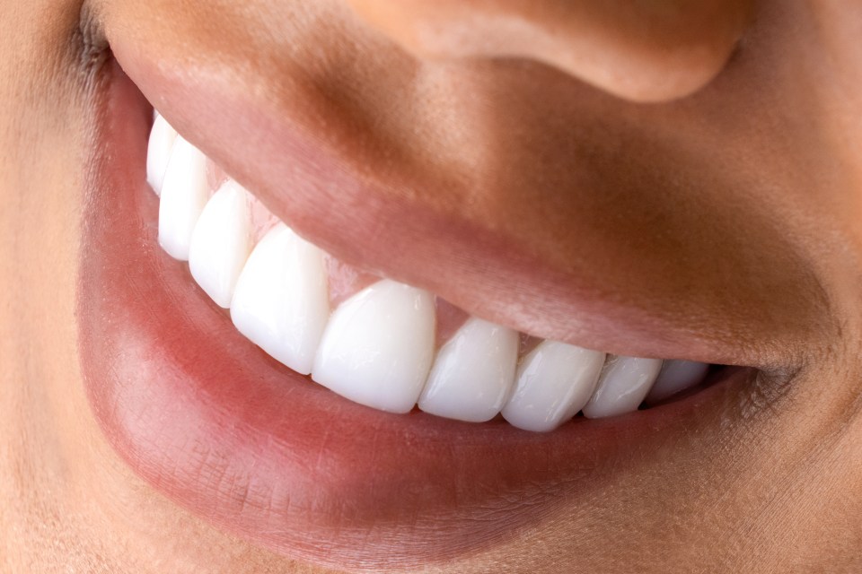 Close-up of a woman's smile showing bright white teeth.