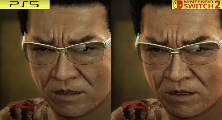 Comparison