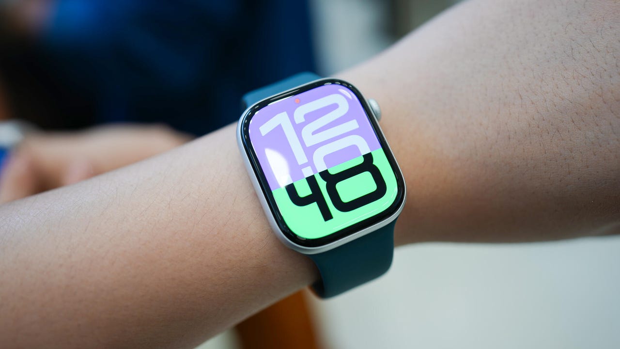 Apple Watch Series 10