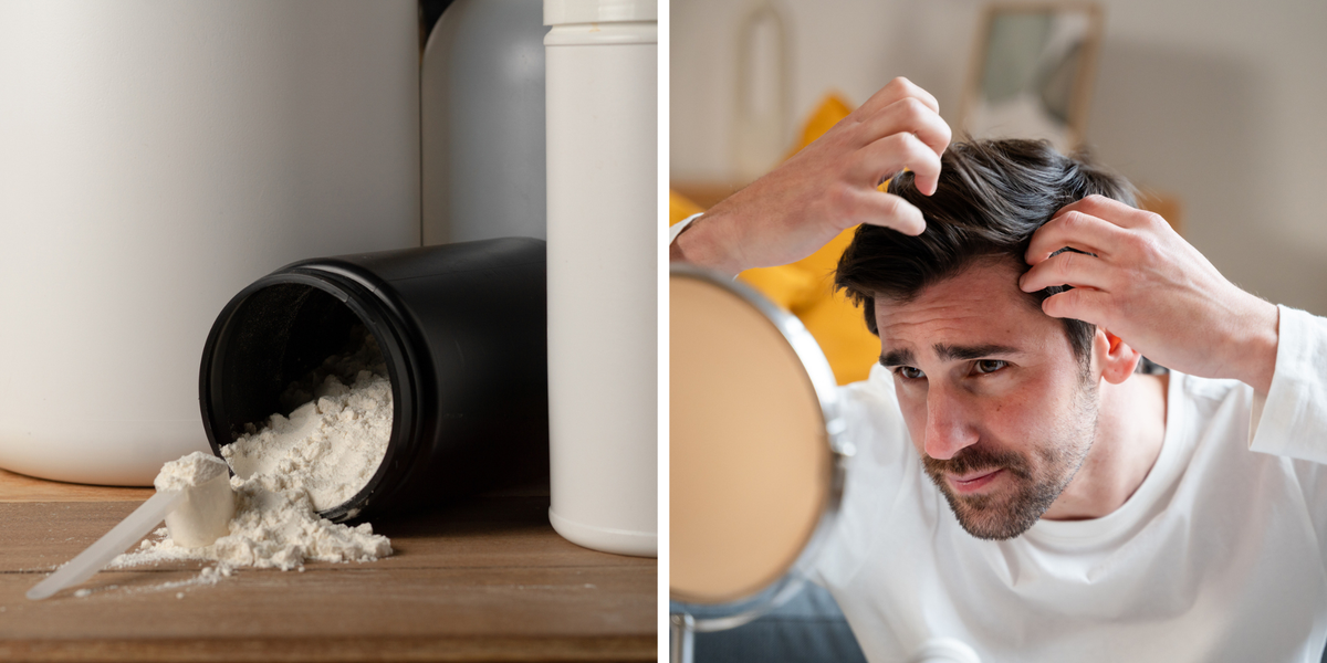 New Study Reveals the Truth about Creatine and Hair Loss