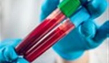 New blood test to boost diagnosis for rare genetic diseases in kids