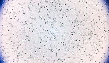 Sperm donor with rare genetic mutation fathered 67 children. Ten now have cancer, prompting calls for reform