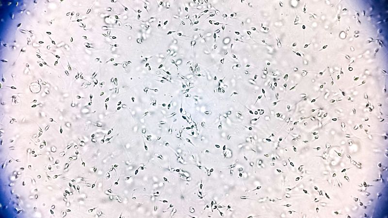 Sperm donor with rare genetic mutation fathered 67 children. Ten now have cancer, prompting calls for reform